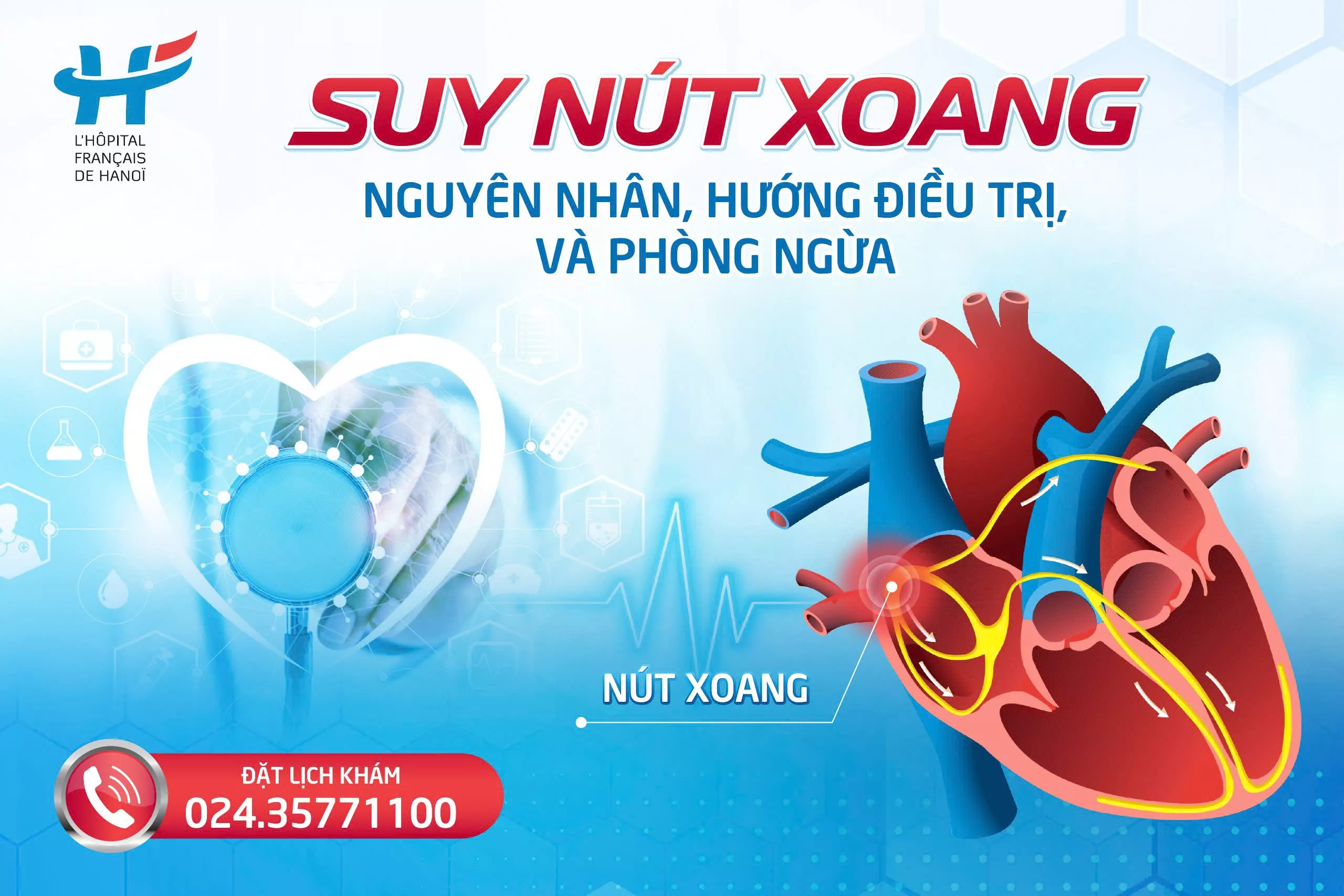 Sick Sinus Syndrome: Causes, Treatments and Preventions